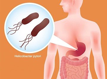 хеликобактер пилори